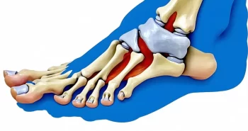 what is a cartiva implant