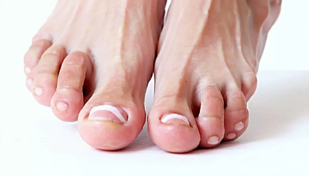 what is cartiva made of