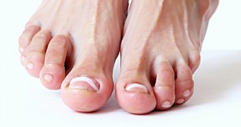 what is cartiva made of