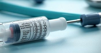 breast biopsy marker side effects