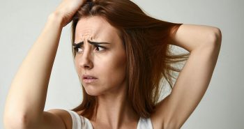 depo provera hair loss