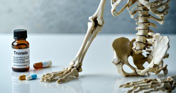 truvada bone density